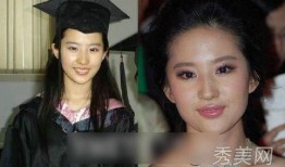 明星爆料整容视频大全最新,明星整容真相大曝光，视频大全揭秘美丽背后的秘密