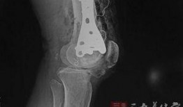 愈合伴侣在线观看,在线观看，情感疗愈之旅