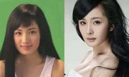 明星爆料整容视频大全最新,明星整容真相大曝光，视频大全揭秘美丽背后的秘密